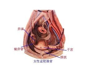 盆腔积液的治疗